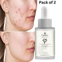 Pack of 2 Cassidy dark spot serum for acne scars with olive squalane for effective skin brightening