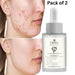 Pack of 2 Cassidy dark spot serum for acne scars with olive squalane for effective skin brightening